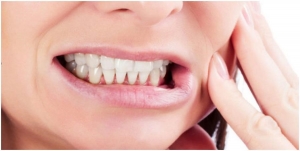 جابجایی دندان بعد از ارتودنسی