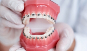 دلایل کج شدن دندان