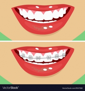 تاثیر دندان عقل در درمان ارتودنسی
