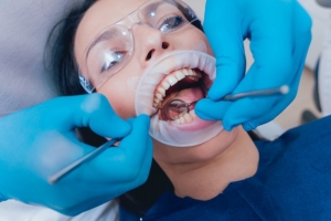  زرد شدن دندان در ارتودنسی