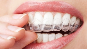 درمان فاصله بین دندانی با اینویزیلاین