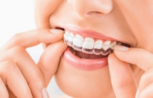 درمان فاصله بین دندانی با اینویزیلاین
