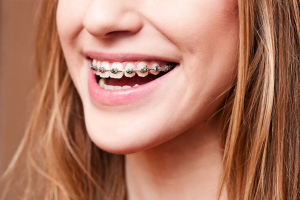 افزایش طول عمر دندان ها با ارتودنسی